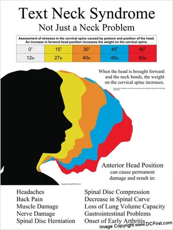 An infographic titled 'Text Neck Syndrome' shows how forward head posture strains the spine.